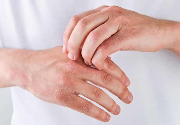 Bakkerseczeem – part of the job?