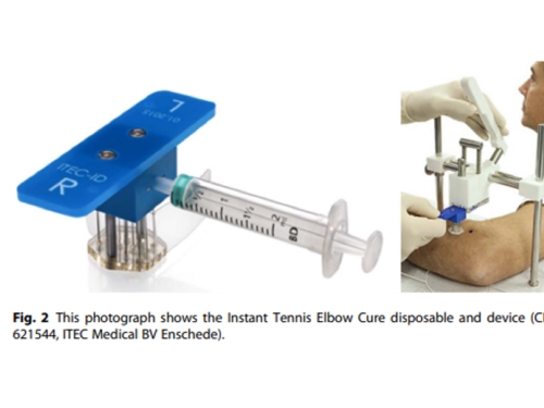 Wat werkt bij de tenniselleboog?